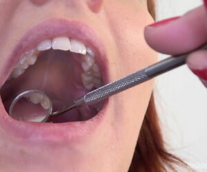 roodharige hottie Geopend haar Onbezonnenheid breed in haar tandarts
