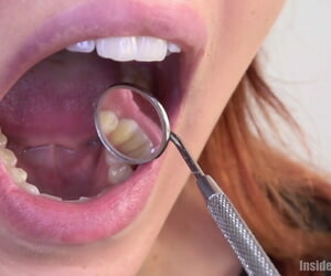 el pelirrojo hottie Se abre su la indiscreción amplia en su dentista