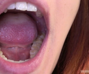 roodharige hottie Geopend haar Onbezonnenheid breed in haar tandarts